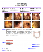 【消化肿瘤】省专家陈路川教授领衔救治七旬结肠癌老人