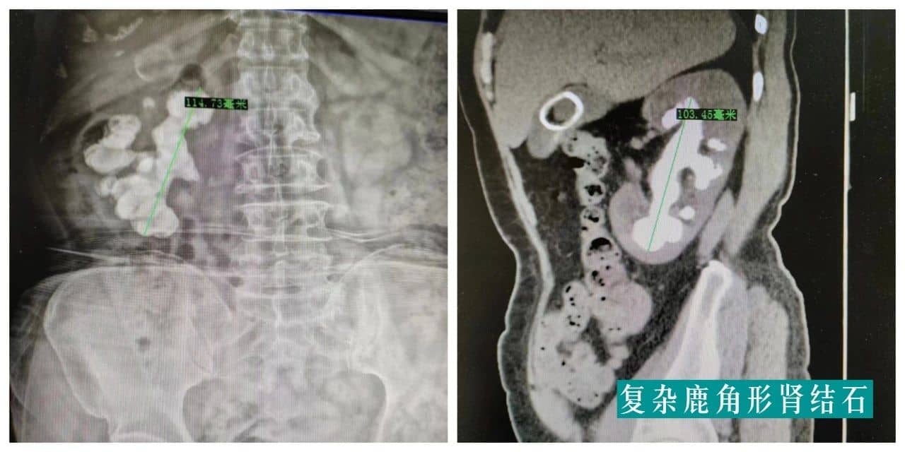 【福德专科】泌尿肾病中心