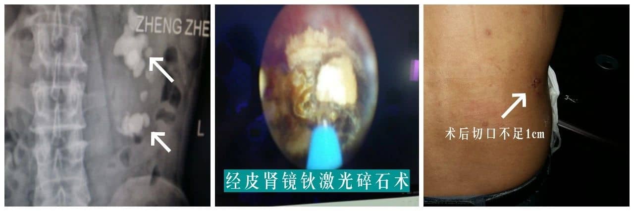 【福德专科】泌尿肾病中心