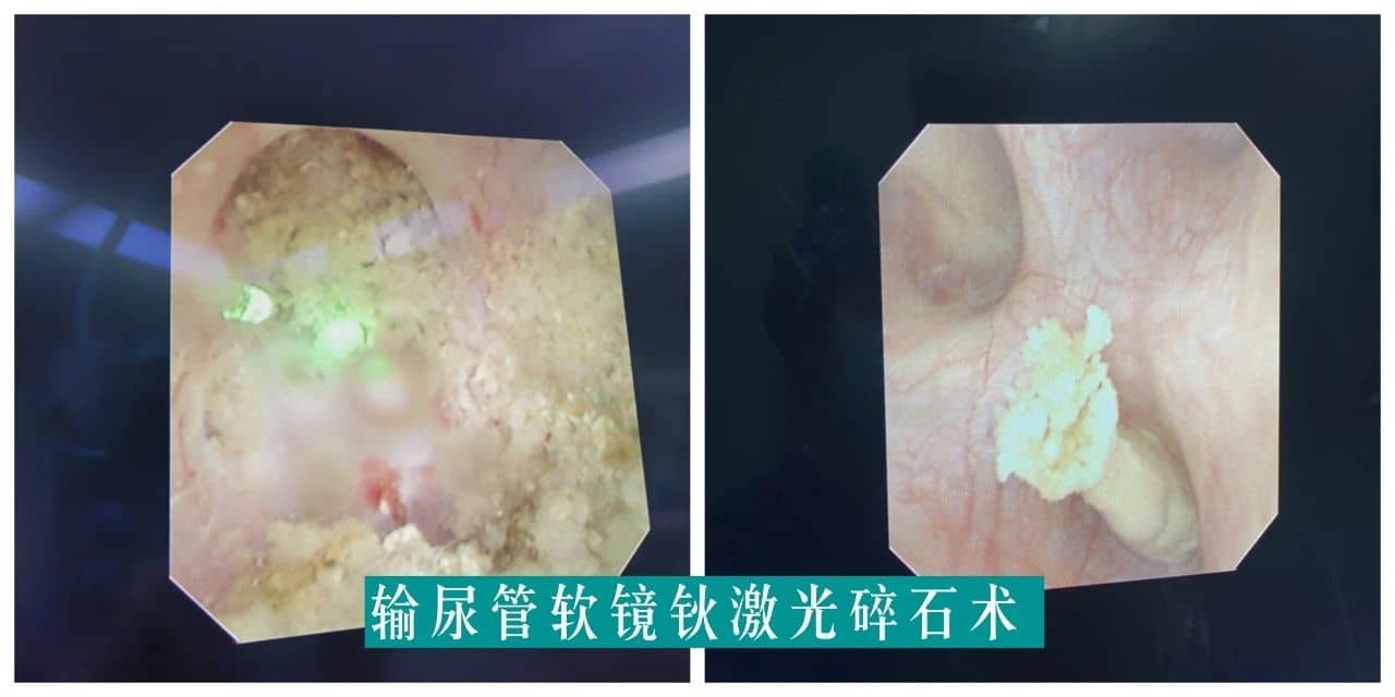 【福德专科】泌尿肾病中心