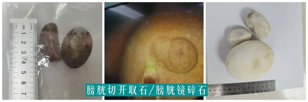 【福德专科】泌尿肾病中心