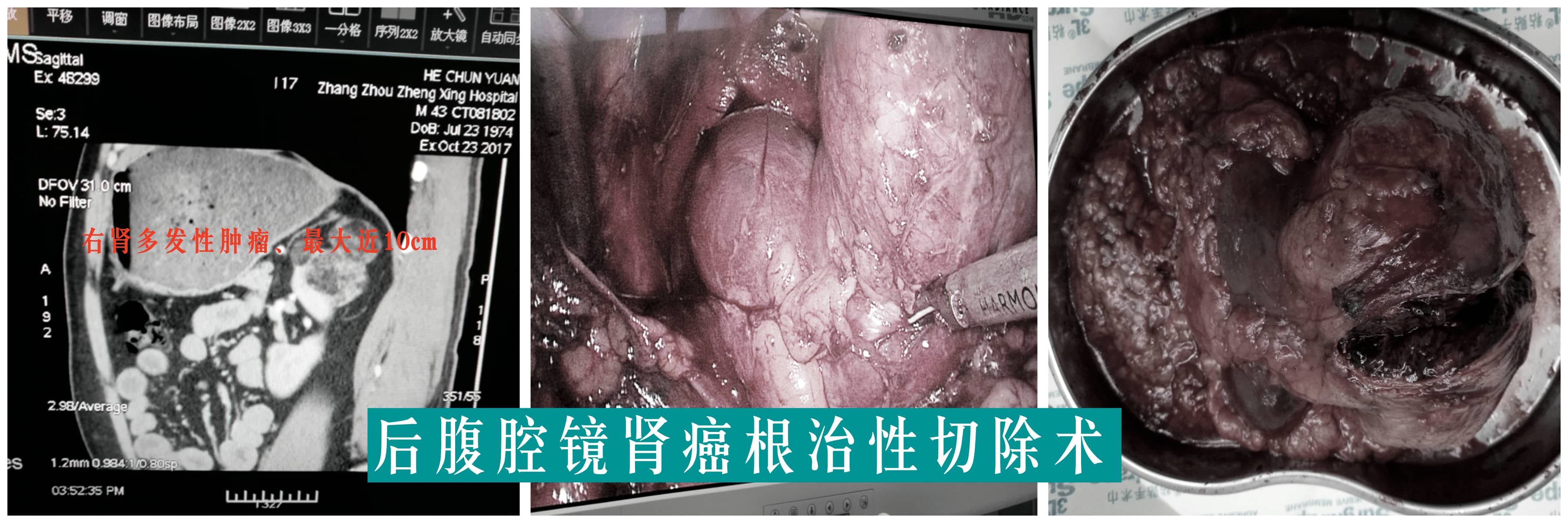 【福德专科】泌尿肾病中心